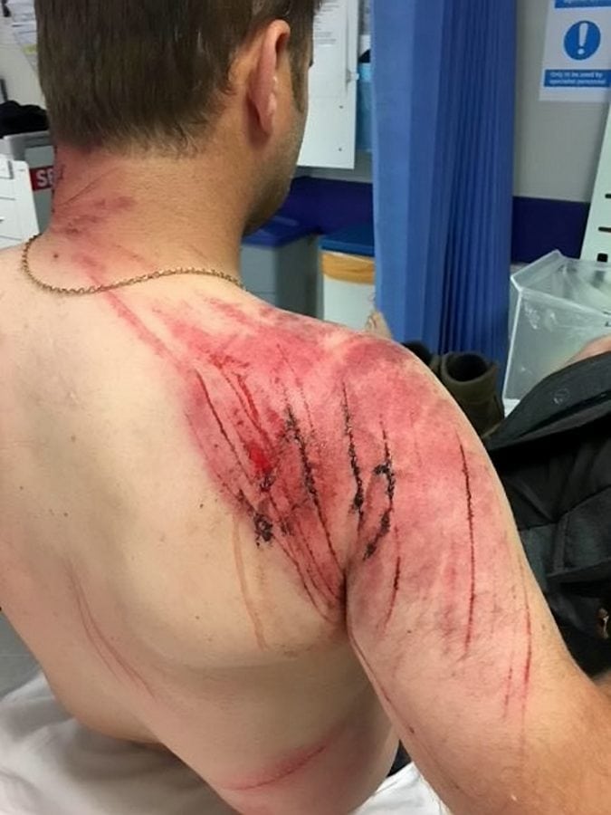 A taxi driver has described how he almost died after being trampled by an angry herd of rampaging cows as he was out walking his dog. Adam Delves, 38, was left badly injured after he was repeatedly stamped on and tossed into the air by the stampeding animals on a public pathway.