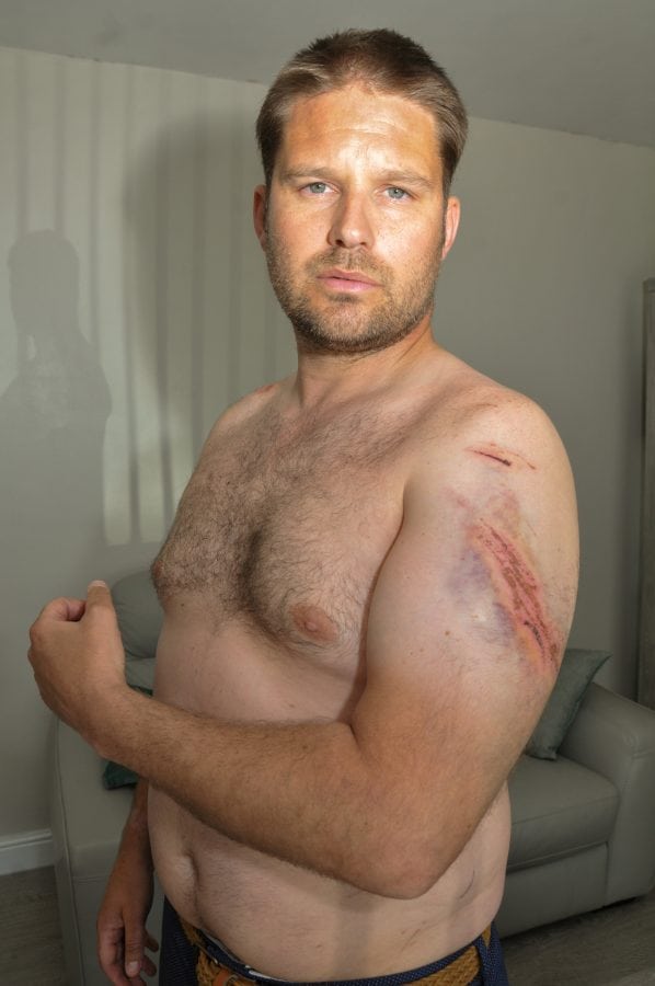 A taxi driver has described how he almost died after being trampled by an angry herd of rampaging cows as he was out walking his dog. Adam Delves, 38, was left badly injured after he was repeatedly stamped on and tossed into the air by the stampeding animals on a public pathway.