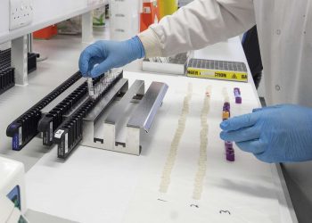 Clinical support technician Douglas Condie extracts viruses from swab samples so that the genetic structure of a virus can be analysed and identified in the coronavirus testing laboratory at Glasgow Royal Infirmary, Glasgow.