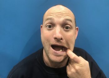 Billy Taylor with his own tooth that he pulled out. Credit;SWNS
