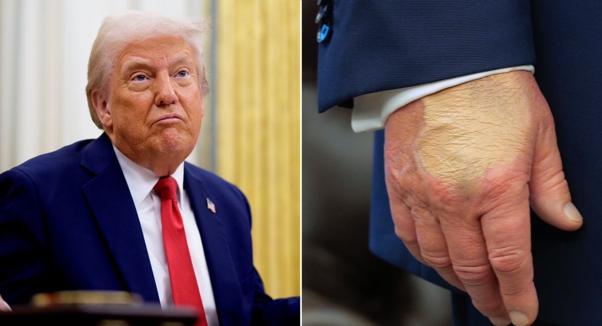 Donald Trump brags about ignoring doctors' advice claiming his health is ‘perfect’