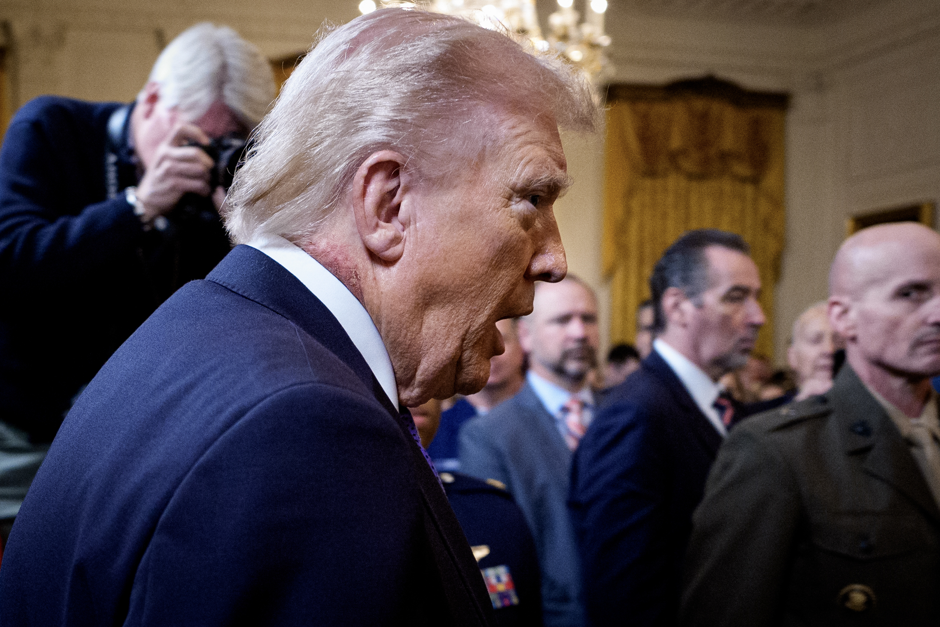 donald trump neck rash
