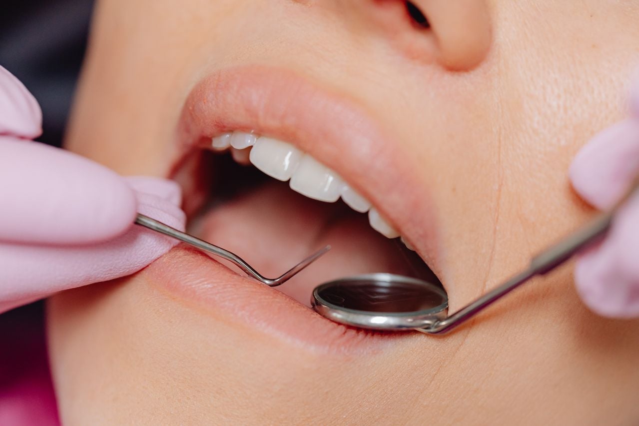 Beyond Lower Prices: How Digital Smile Design is Changing Dental Tourism in Turkey